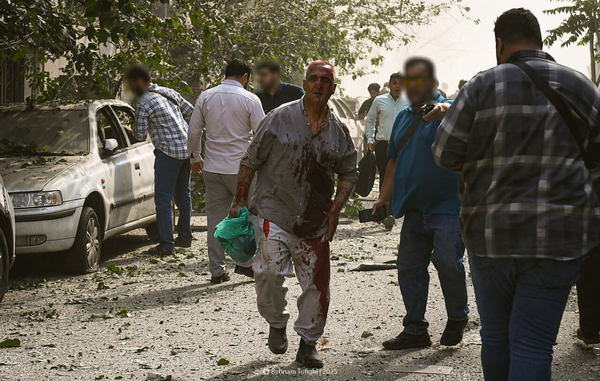 آمار شهدا و مجروحین منتشر شد آمار شهدا و مجروحین منتشر شد