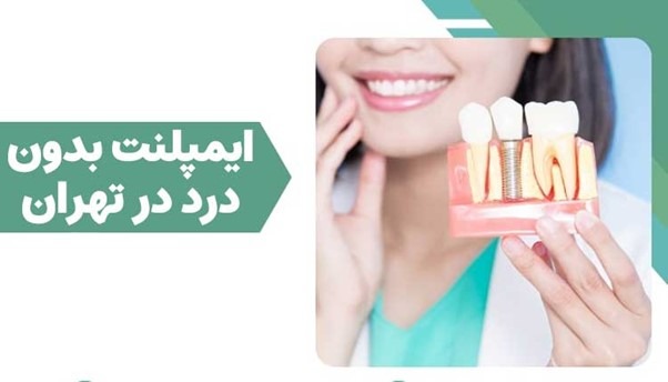 ایمپلنت بدون درد در تهران