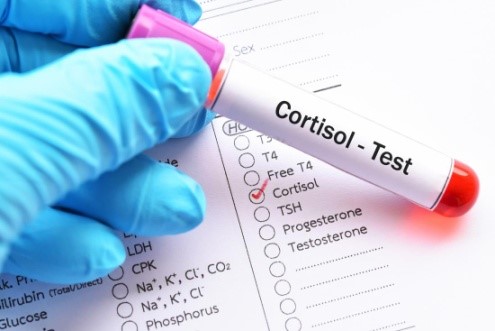 آزمایش کورتیزول چیست؟