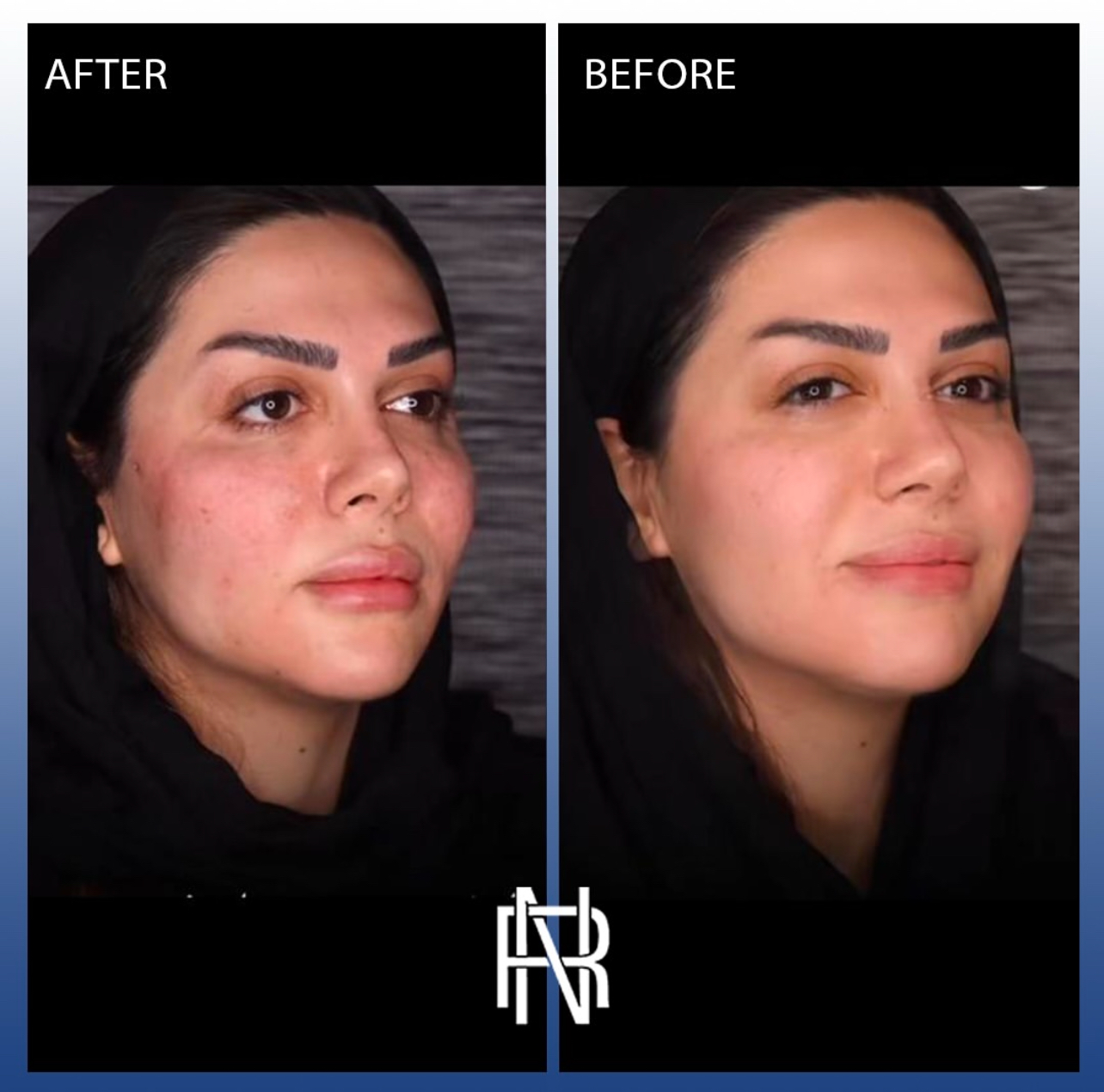 داستان تغییر من؛ از پوست آسیب دیده تا درخشش دوباره در کلینیک اسکینیکا